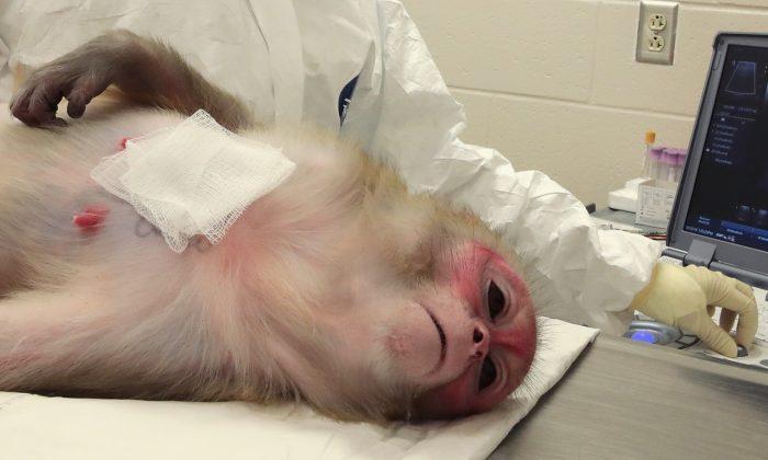 Chinese Scientists Implant Human Brain Genes into Monkeys