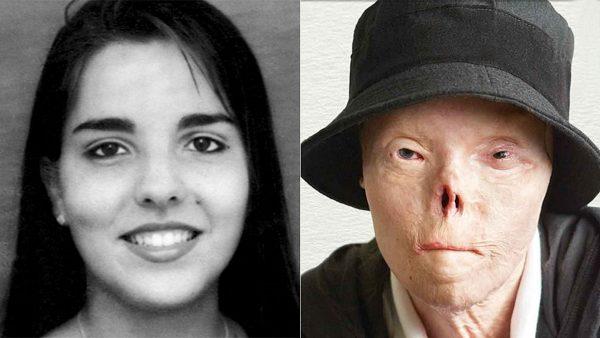 Jacqueline Saburido became the face of a campaign to end drunk driving after being left disfigured following a horrible DUI crash in Texas in 1999. She died on April 20, 2019, according to family. (Texas Department of Transportation)