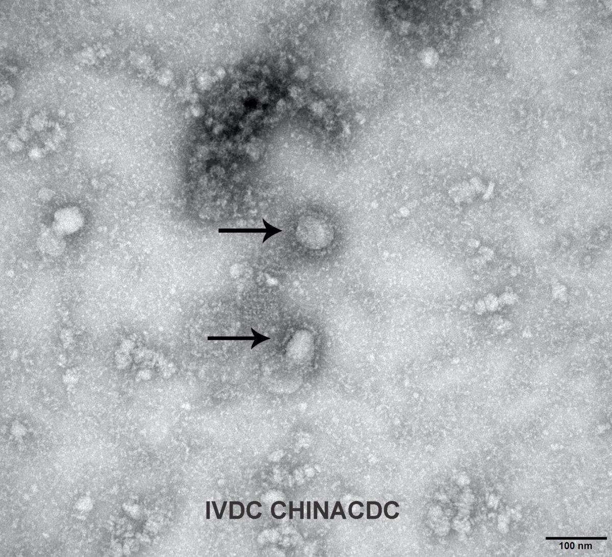 A Transmission Electron Microscopy image of the first isolated case of the coronavirus, on January 27, 2020. (Handout via Reuters)