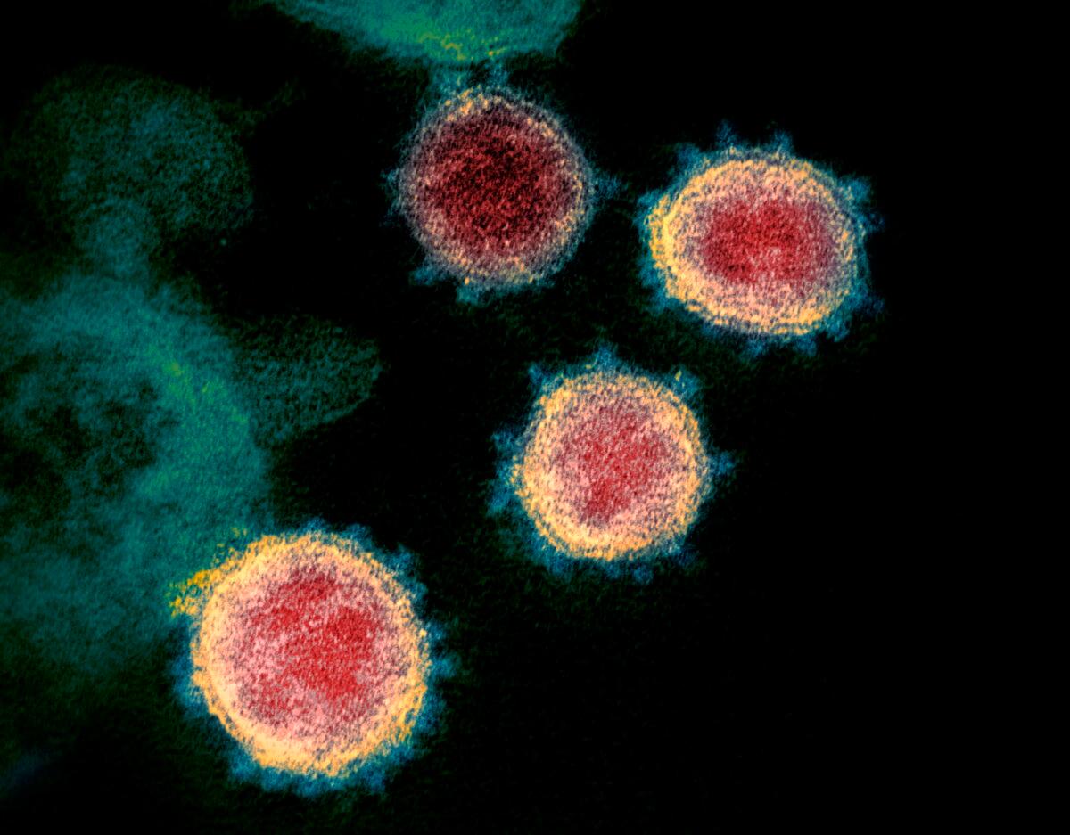 This undated electron microscope image made available by the U.S. National Institutes of Health in February 2020 shows the CCP virus, which causes COVID-19. (Niaid-RML via AP/The Canadian Press)