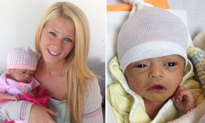 Woman Adopted Abandoned Baby With 3 Percent of Brain, Giving Her a Home While She Lived