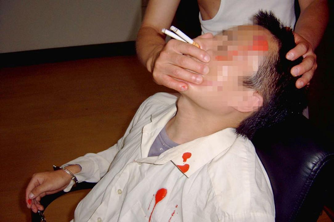 Reenactment of stuffing nostrils with lit cigarettes. (<a href="https://en.minghui.org/">Minghui.org</a>)