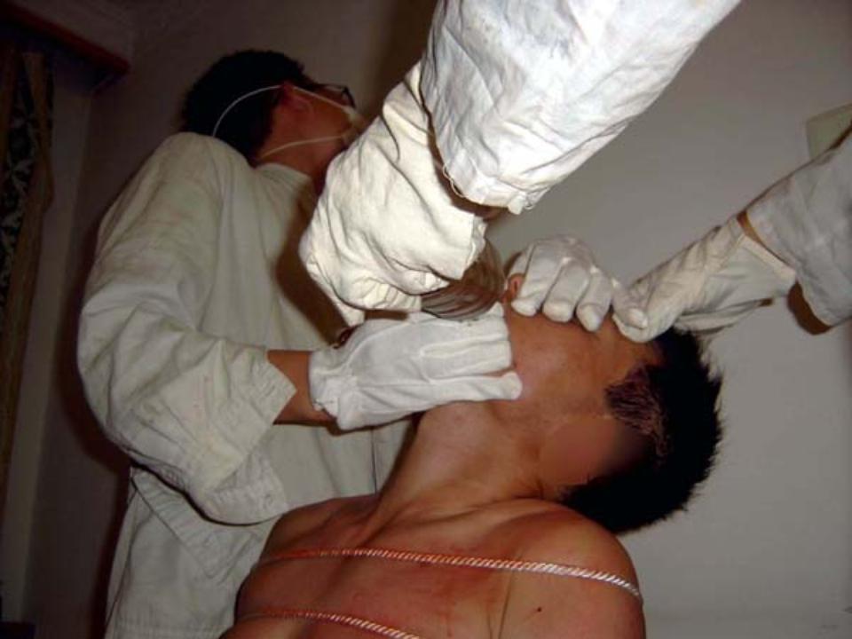 Reenactment of force-feeding. (<a href="https://en.minghui.org/">Minghui.org</a>)