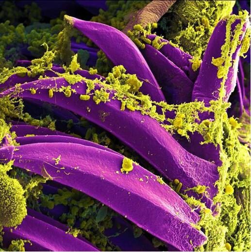 This digitally colorized scanning electron microscopic image depicts yellow-colored Yersinia pestis bacteria, which had gathered on the proventricular spines of a Xenopsylla cheopis flea. These spines line the interior of the proventriculus, a part of the flea’s digestive system. The Y. pestis bacterium is the pathogen that causes plague. (National Institute of Allergy and Infectious Diseases)