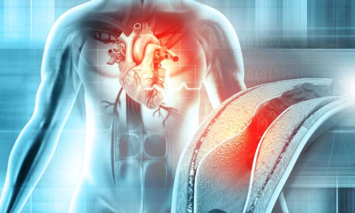 Why Heart Attacks Happen—Expert Shares Key Reason