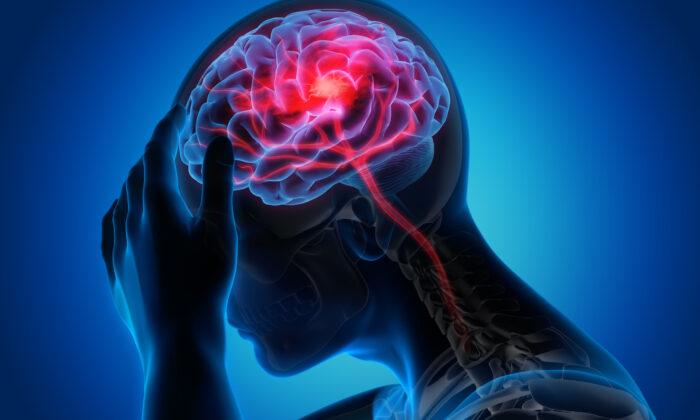 Stroke Could Be Transmissible, Study Finds