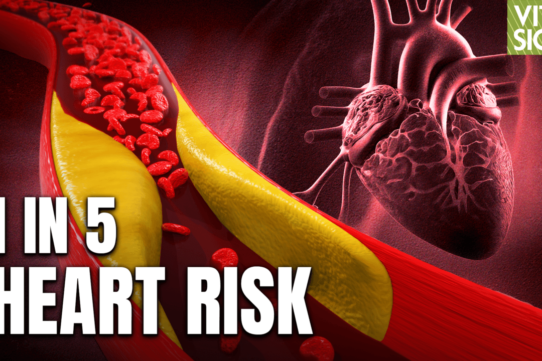 ‘Genetic’ Cholesterol is High in Over 20 Percent of Americans: Leading Heart Doctor Seth Baum MD