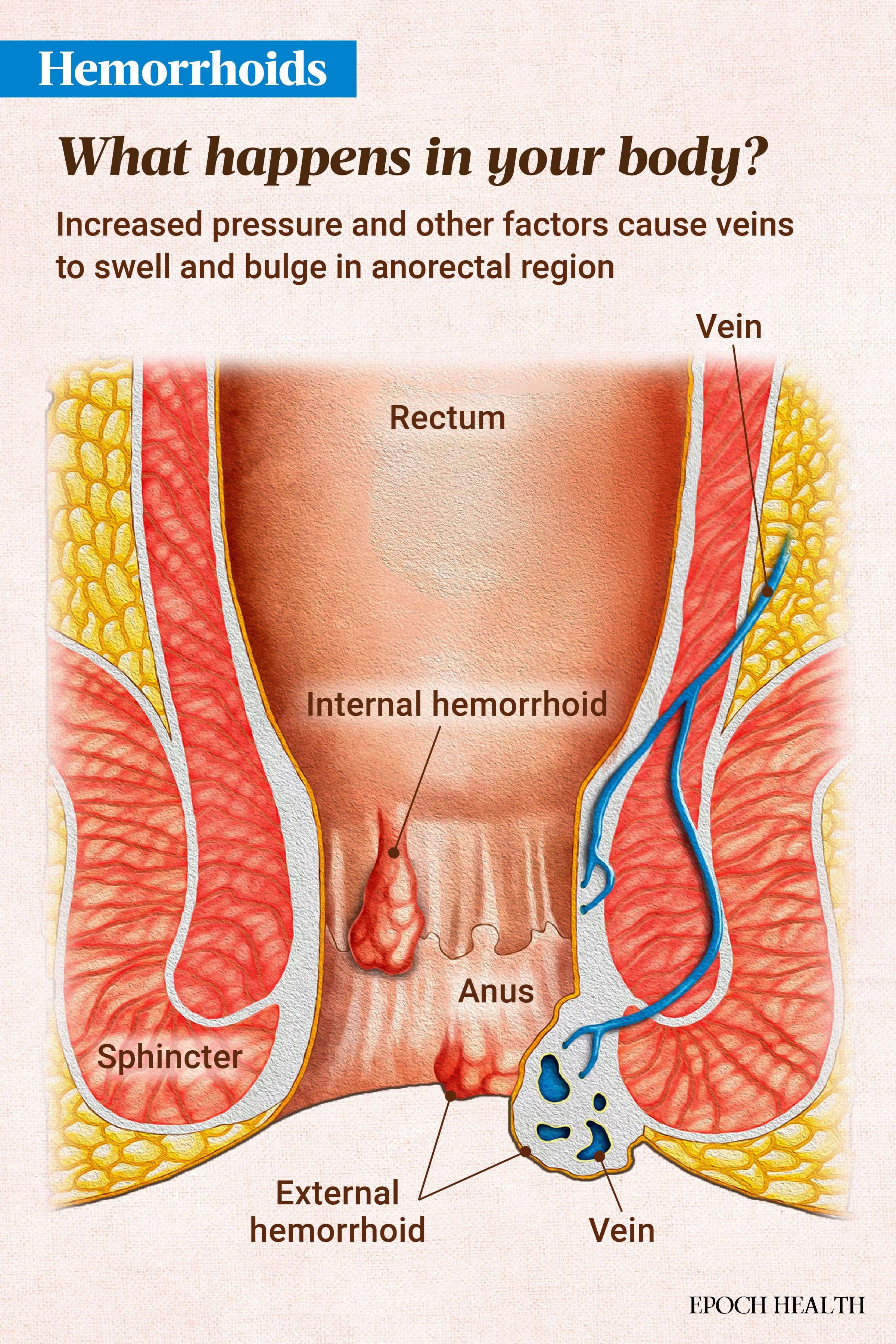 image-5681116