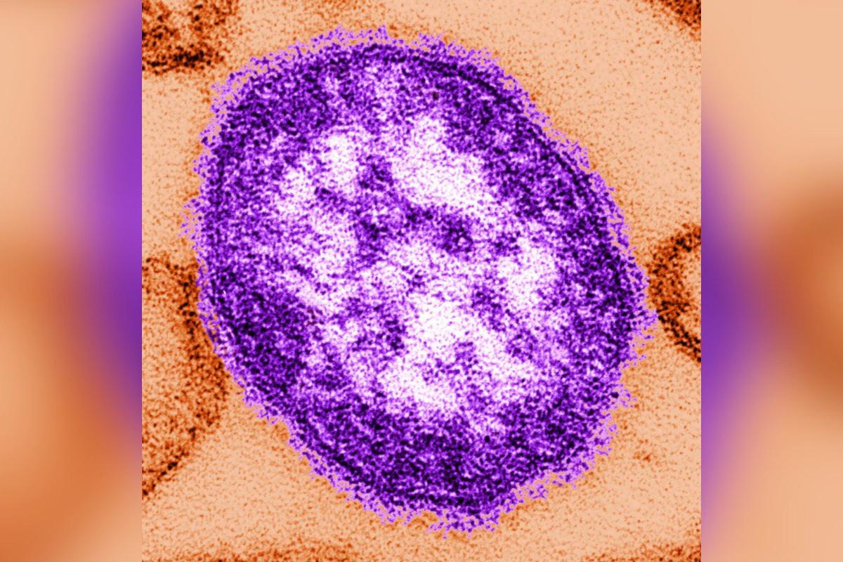 Health Officials Warn of Possible Measles Exposure at Major DC-Area Airport