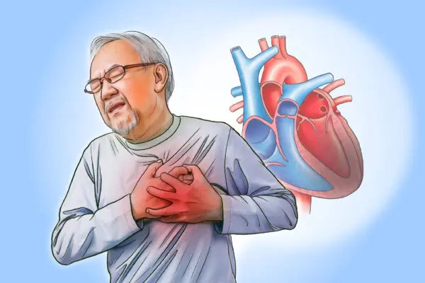 Heart Disease: When Chest Pain Becomes Serious–Treatment Options and Natural Approaches