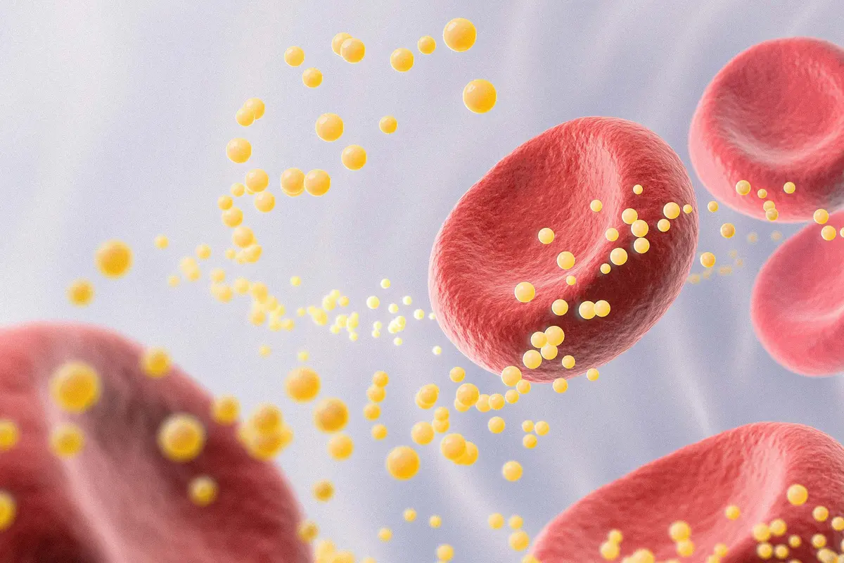Is High Cholesterol Really Bad for You? It Depends