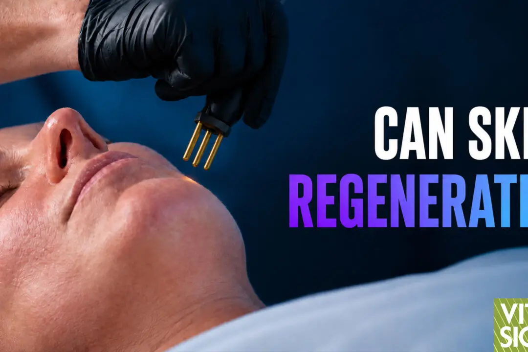 Nitrogen Plasma: Skin Treatment Hope for Acne Scars, Wrinkles, Sagging?