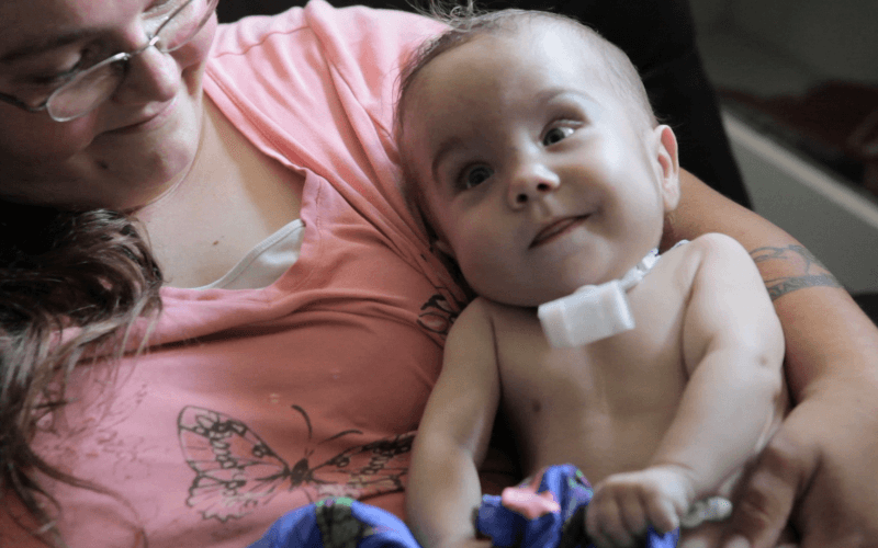 3-D-Printed Implant Saves Baby’s Life