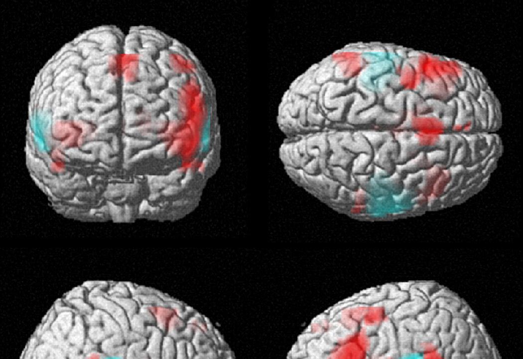 Right-Brain, Left-Brain Just a Myth, Say Neuroscientists