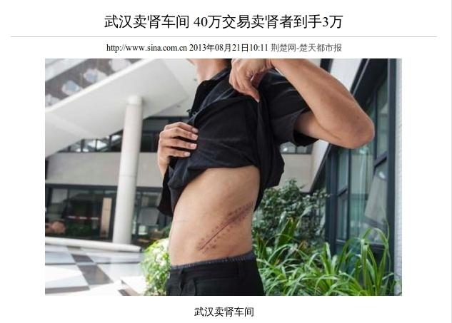 Chinese Authorities Break Up Organ Transplant Ring