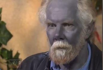 Blue Man Dies: Paul Karason Dead at 62, Had Blue Skin (+Photo)