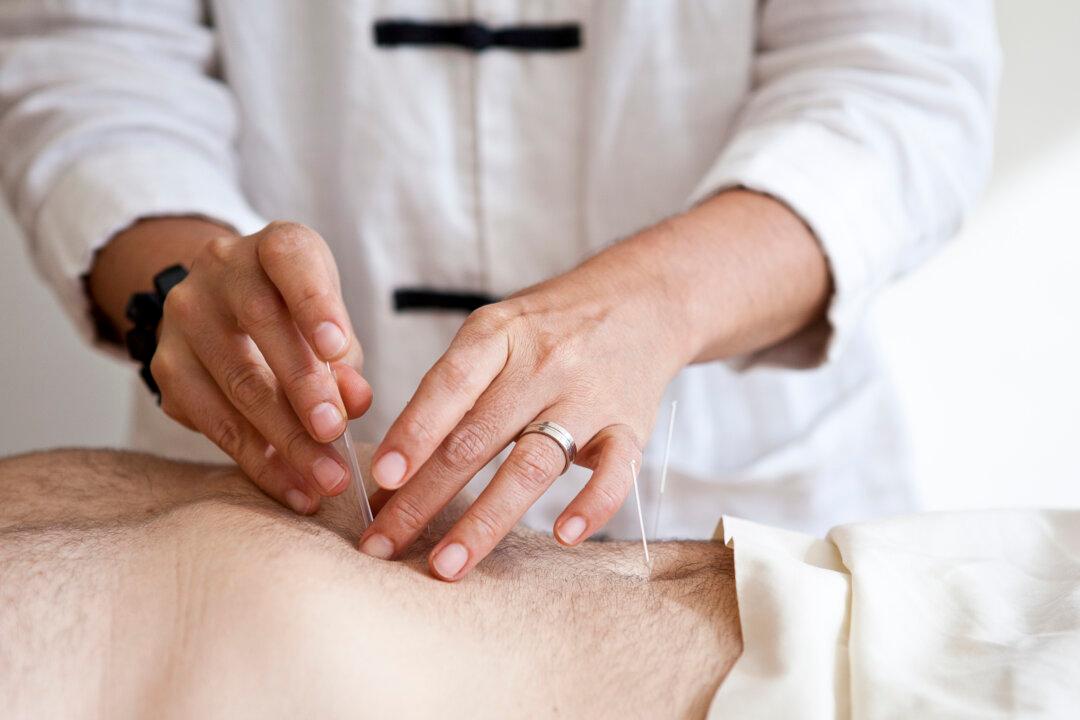 Improve Digestion With Acupuncture and Chinese Medicine