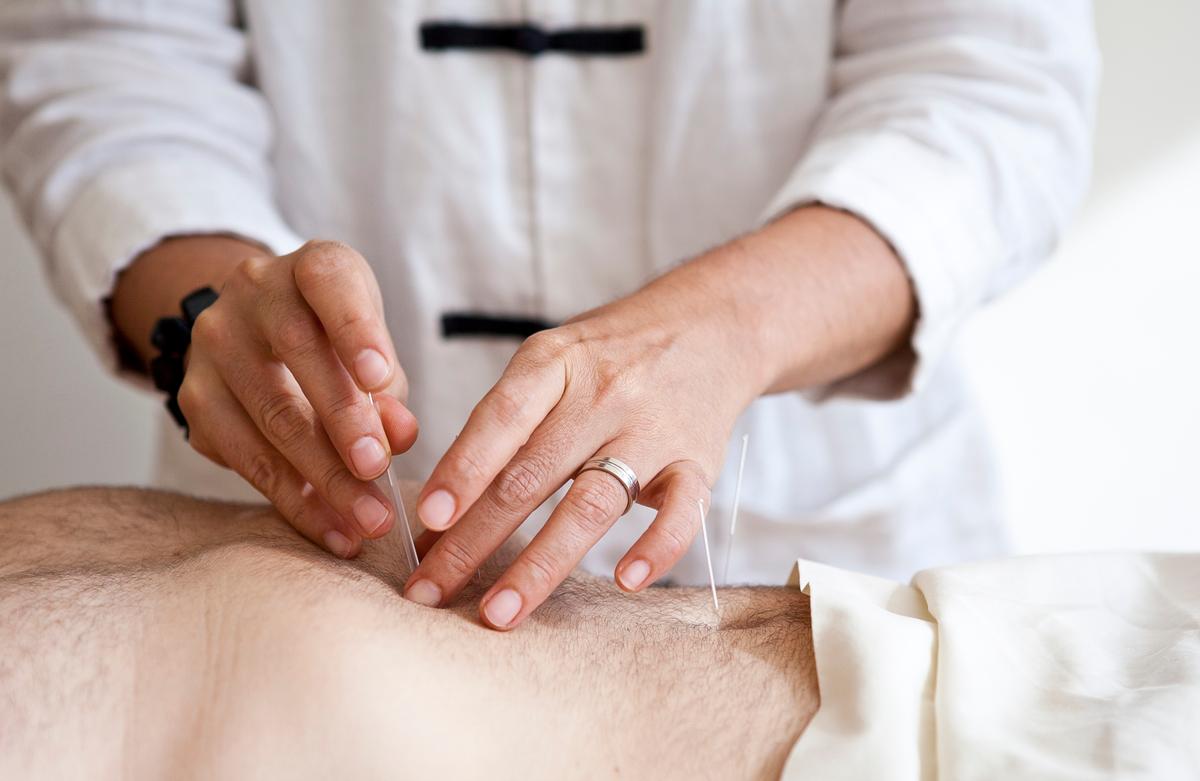 Improve Digestion With Acupuncture and Chinese Medicine