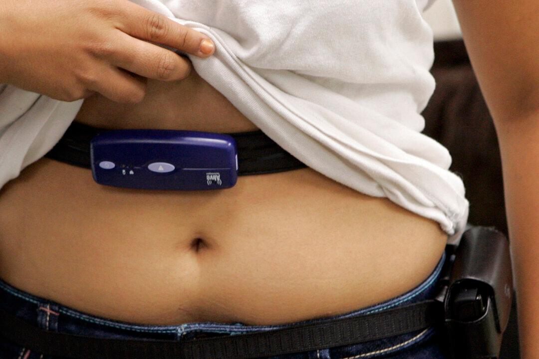 Obesity: US Girls Entering Puberty Earlier Than Ever, Linked to Obesity