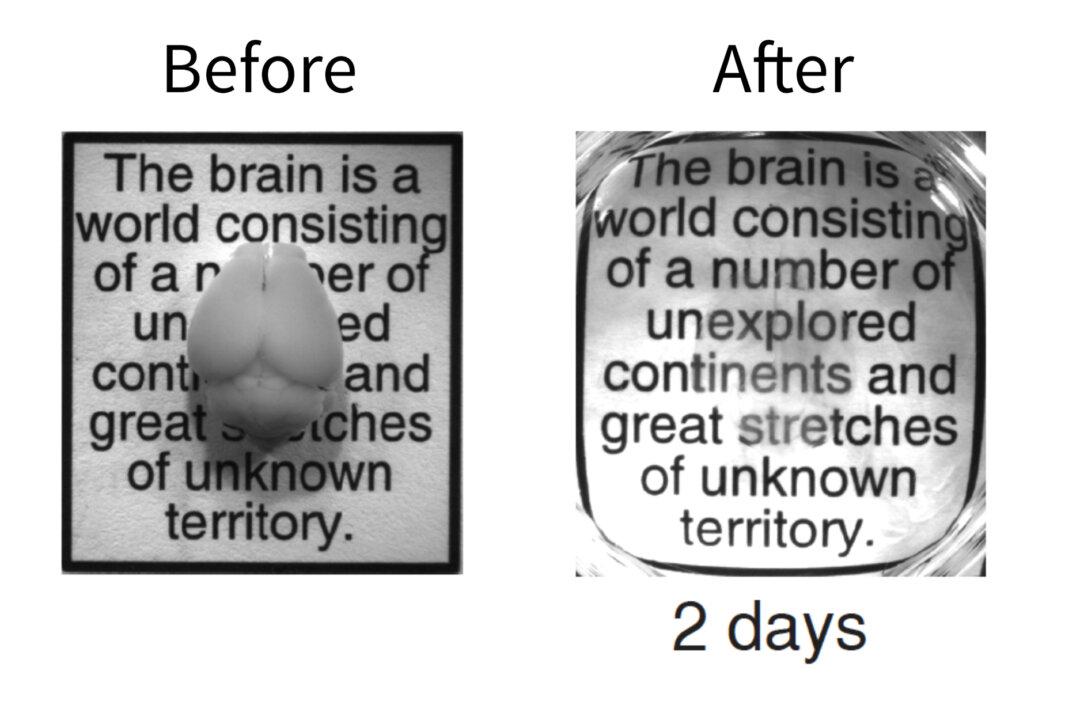 Breakthrough Method Turns Brain Invisible
