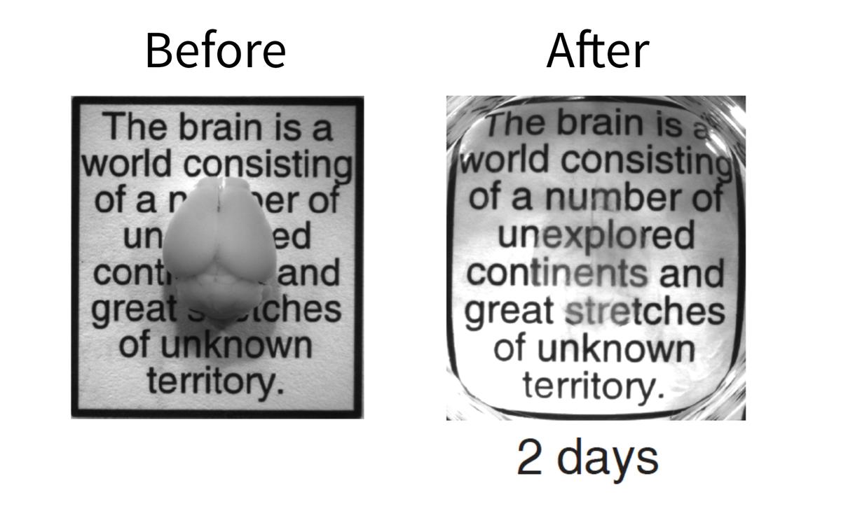 Breakthrough Method Turns Brain Invisible