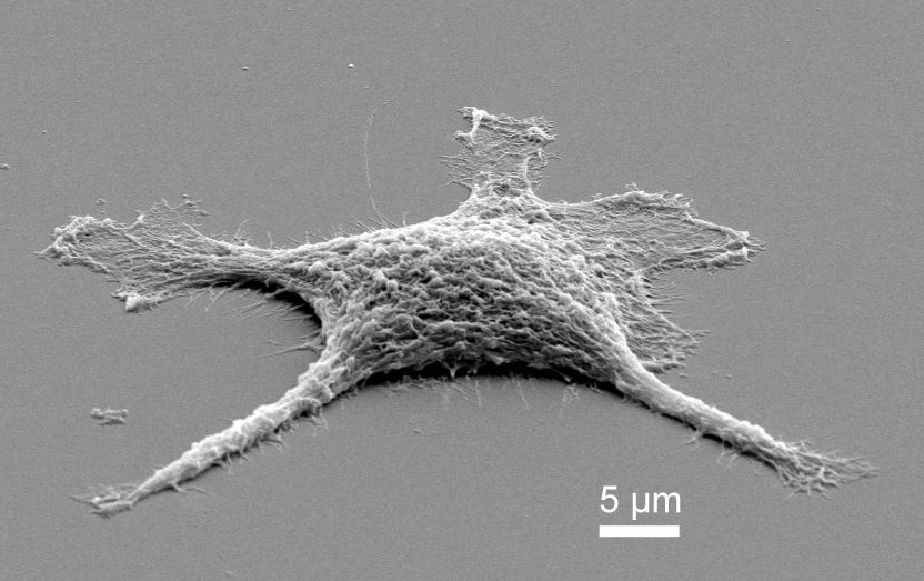 A Real-Life Zombie Cell: How It Works After It’s Dead