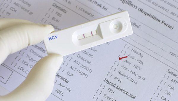 Hepatitis C virus (HCV) positive. (Middle East Institute)
