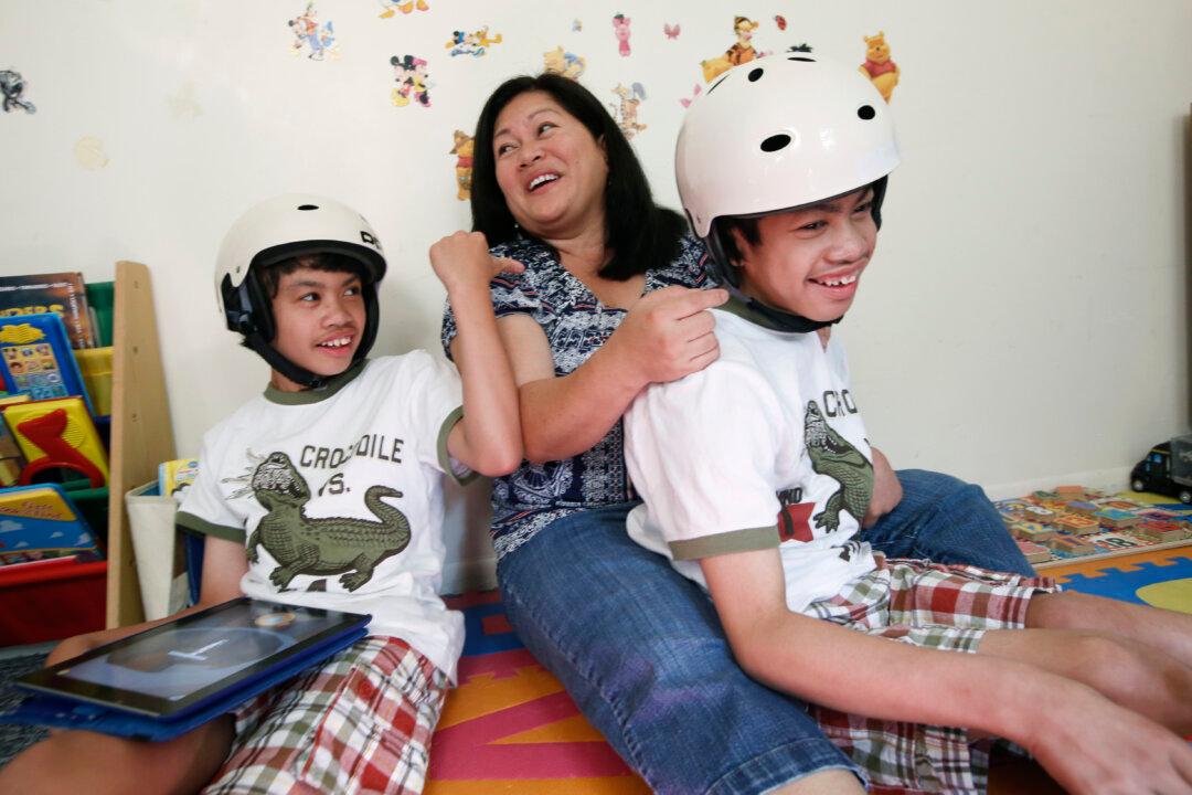 Decade On, Separate Lives for Once-Conjoined Twins