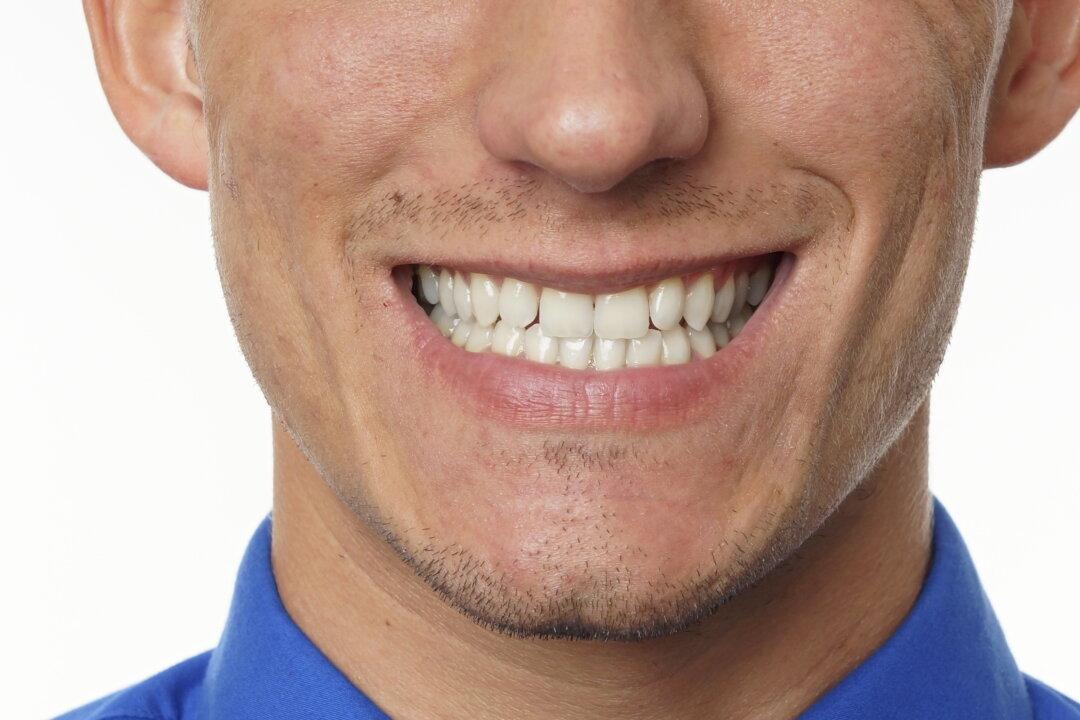 A Rundown on Dental Fillings