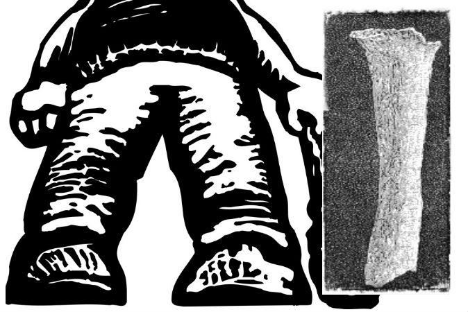 Did Giants Exist? Part 2: Where Are the Skeletons Now?