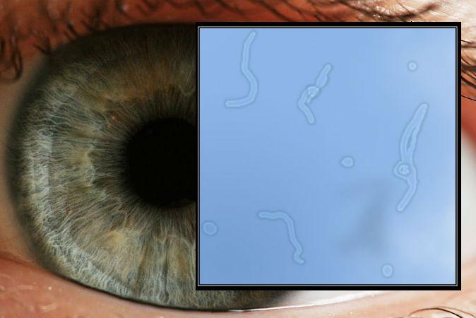 The Eye Floater Phenomenon: Between Science and Spirituality