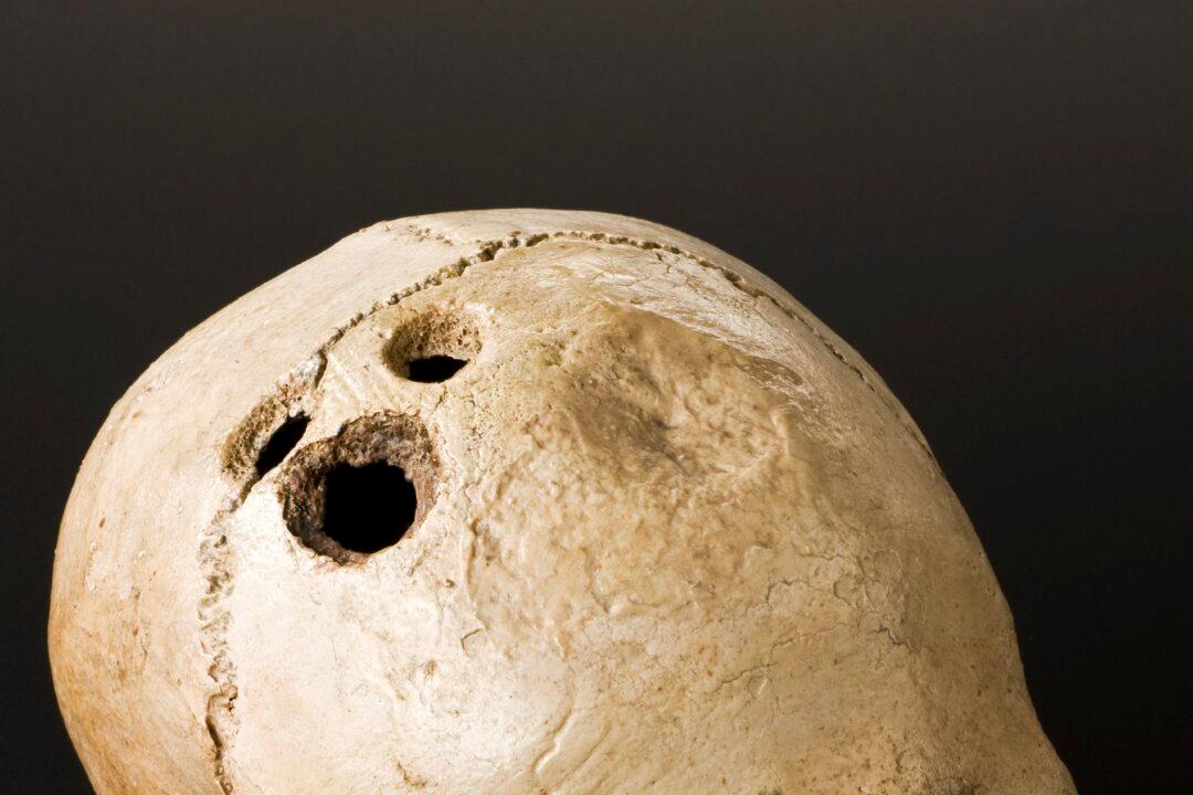 Advanced Ancient Knowledge: Brain Surgery 2,500 Years Ago