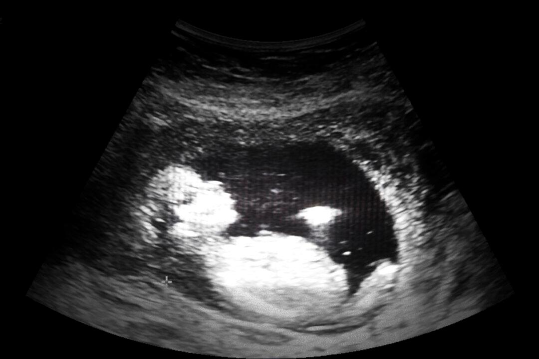 Trump Administration Reviewing Contracts With Fetal-Tissue Providers