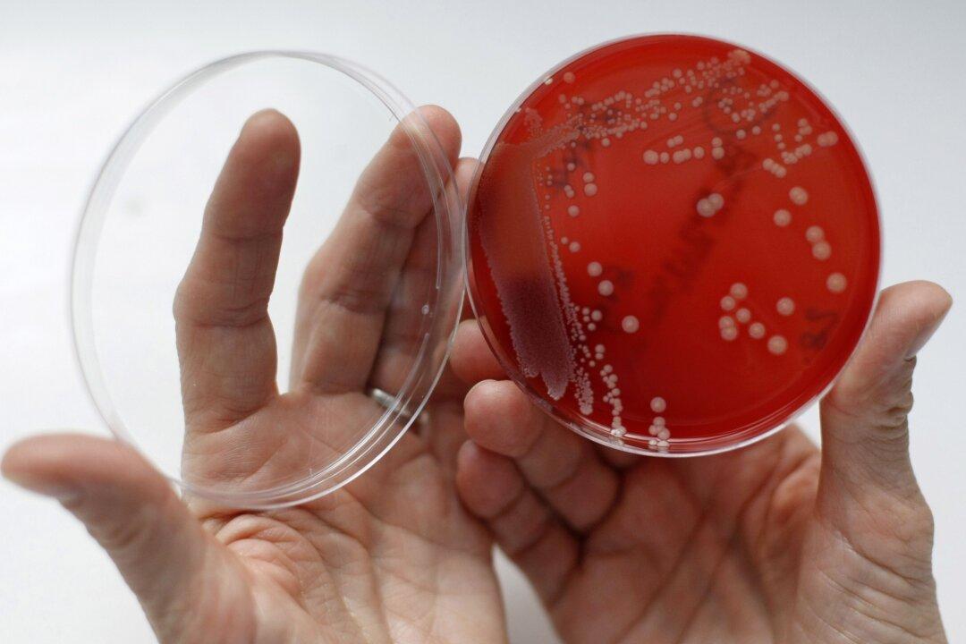 Multiple LAPD Officers Infected With Drug-Resistant MSRA: Reports