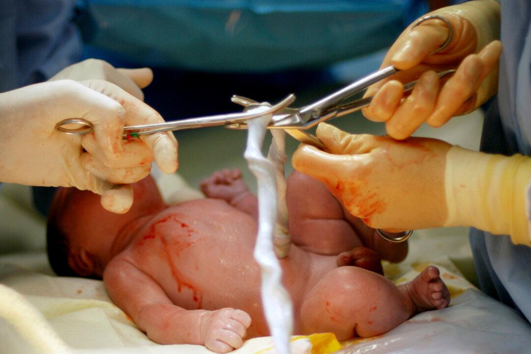 Delay Clamping Babies’ Umbilical Cords for Better Health and Development