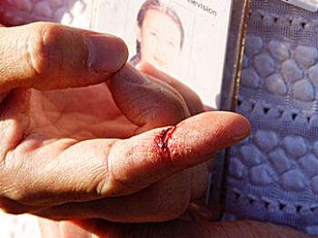 NTDTV Reporter Attacked at Fukien American Association