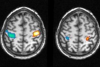 Lucid Dreamers Help to Measure Dream Content
