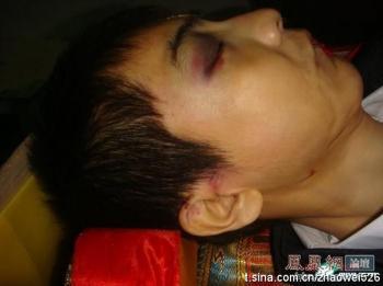 Violent Death of Chinese College Student Zhao Wei, Triggers Indignation Online