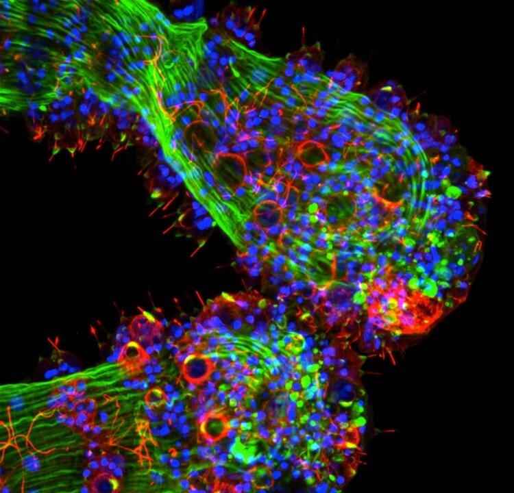 SCIENCE IN PICS: How the Eyeless Hydra Sees