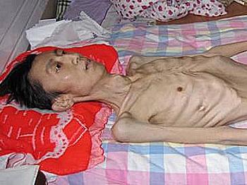 Starvation Policy Puts 65 Prisoners at Risk in China