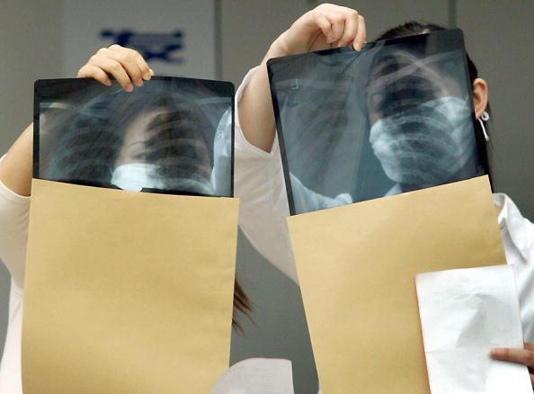 Students Contract Tuberculosis from Immunization in Hunan, China