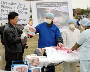 Doctors in China Working Overtime on Organ Transplants