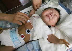 Baby with Three Arms Undergoes Successful Operation