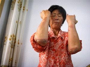 Lady Arrested Again After Being Tortured by Police