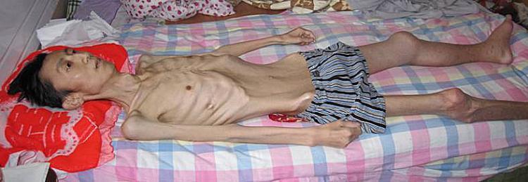 Falun Gong practitioner Zhu Hongbin died after being tortured and starved during his illegal imprisonment at Daqing Prison. (Minghui.org)