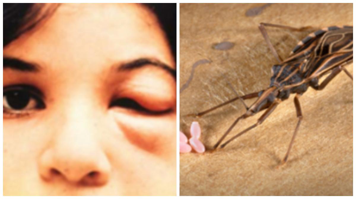 How Deadly Are ‘Kissing Bugs’ Really?