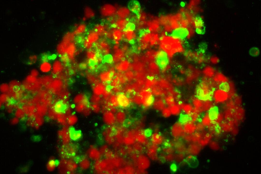 Mysterious Lipids Increase as Cancer Cells Die