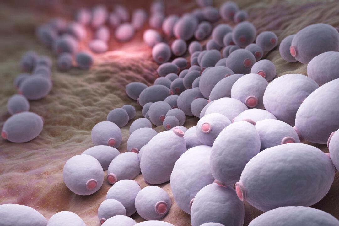 4 Symptoms of Candida Overgrowth