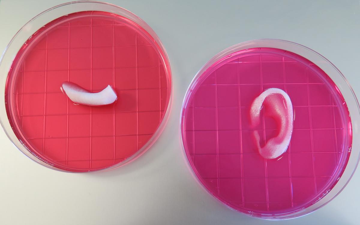 Amazing 3D Printer Can Create Ears, Jawbone, and Muscle