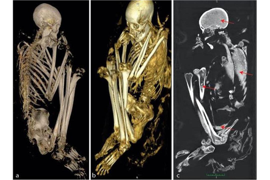 Scans and DNA Tests Reveal the Secrets of a Rare African Mummy